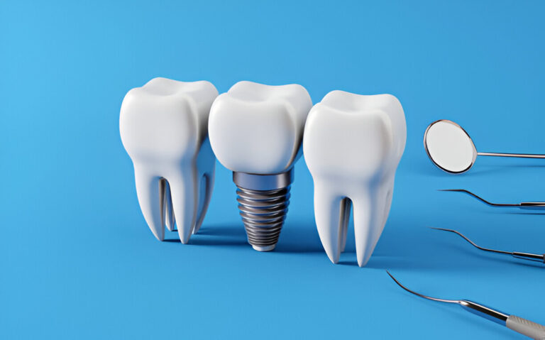 Art and Science of Dental Implants