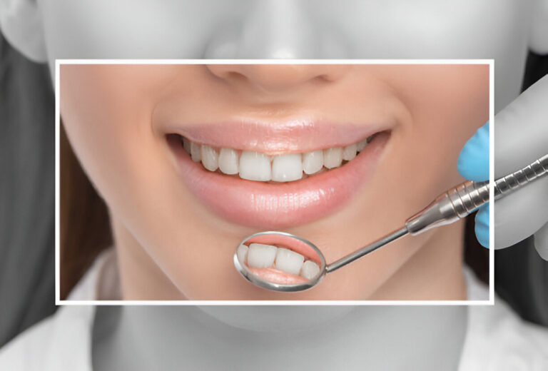 Unlocking a Brighter Smile
